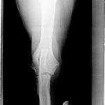 X-ray of Pasha's right elbow made in 2016.