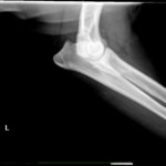 X-ray of Pasha's right elbow made in 2018.