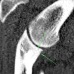 art of a ct-scan of a big dog's left front leg yet another section
